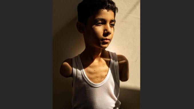 una-imagen-sobre-las-secuelas-de-la-guerra-en-ninos-gazaties-gana-el-world-press-photo.jpg Una imagen sobre las secuelas de la guerra en niños gazatíes gana el World Press Photo