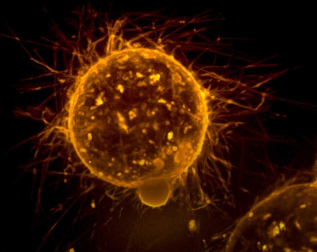 Un estudio en Hong Kong muestra resultados «prometedores» contra tres tipos de cáncer