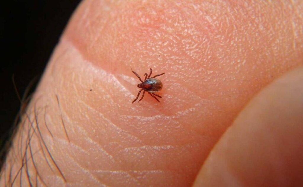 ¿qué es y cómo se contagia la Rickettsiosis?