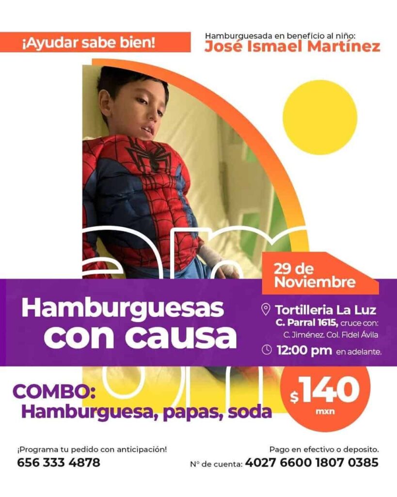 Realizan hamburguesada para ayudar a José Ismael; agentes municipales se suman